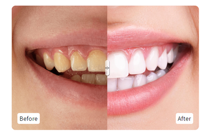 Hismile - Teeth Brightening Serum V34 (Original)